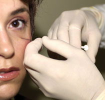 la jolla cosmetic surgery, la jolla botox.