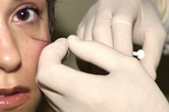 plastic surgery la jolla.